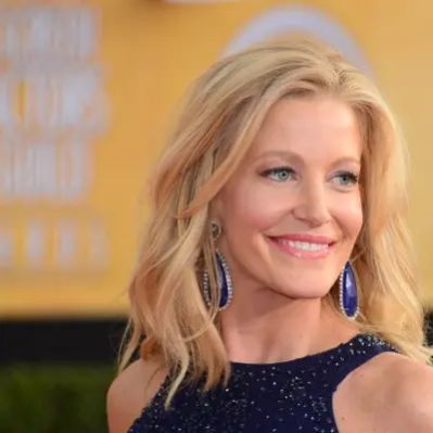 Anna Gunn Net Worth